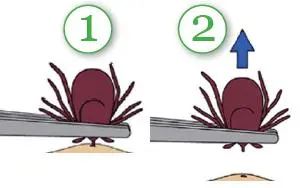 Removing A Tick